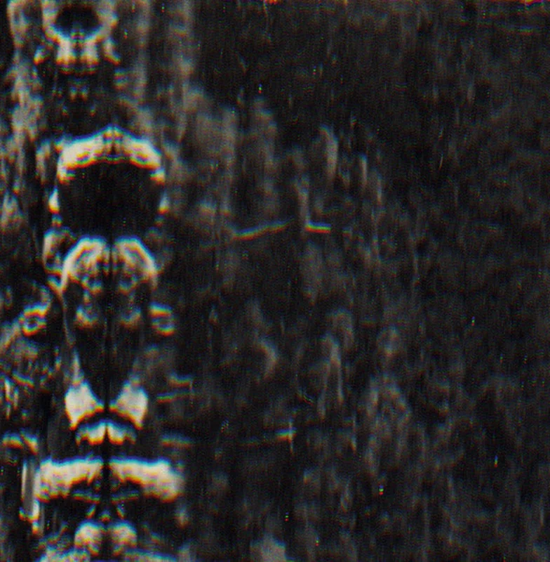 O MORTO The Forest, The People And The Spirits